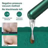 INSMART Blackhead Remover Pore Vacuum with 42℃ Thermal Therapy, Red/Blue Light & 6 Detachable Probes – USB Rechargeable Facial Suction Tool for Deep Cleansing, Comedone Extraction