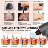 INSMART Electric Blackhead Remover - Pore Vacuum Cleaner with Heating Mode, 3 Suction Levels & 5 Attachments, Facial Comedone Extractor Kit for Deep Cleansing